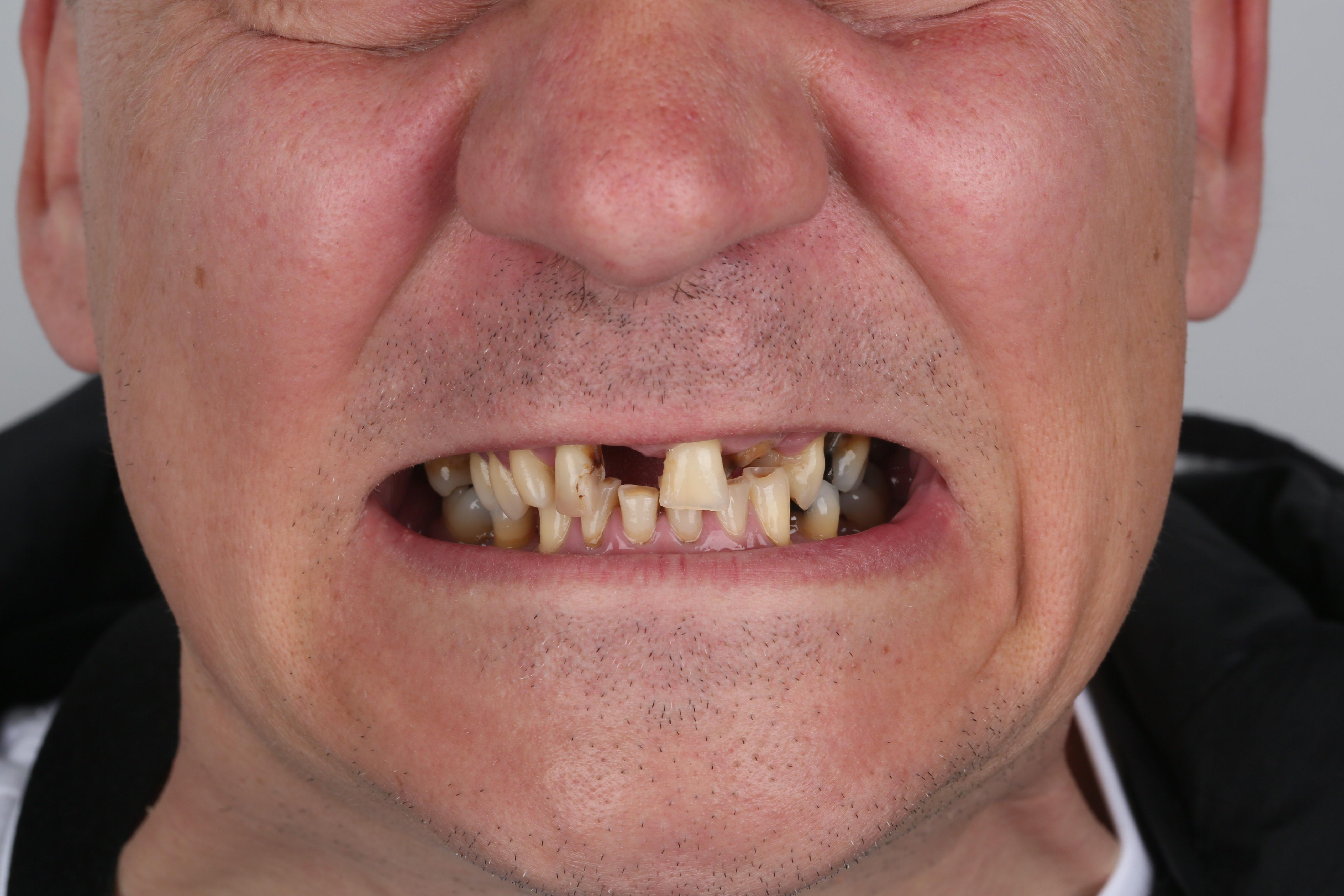 Before treatment